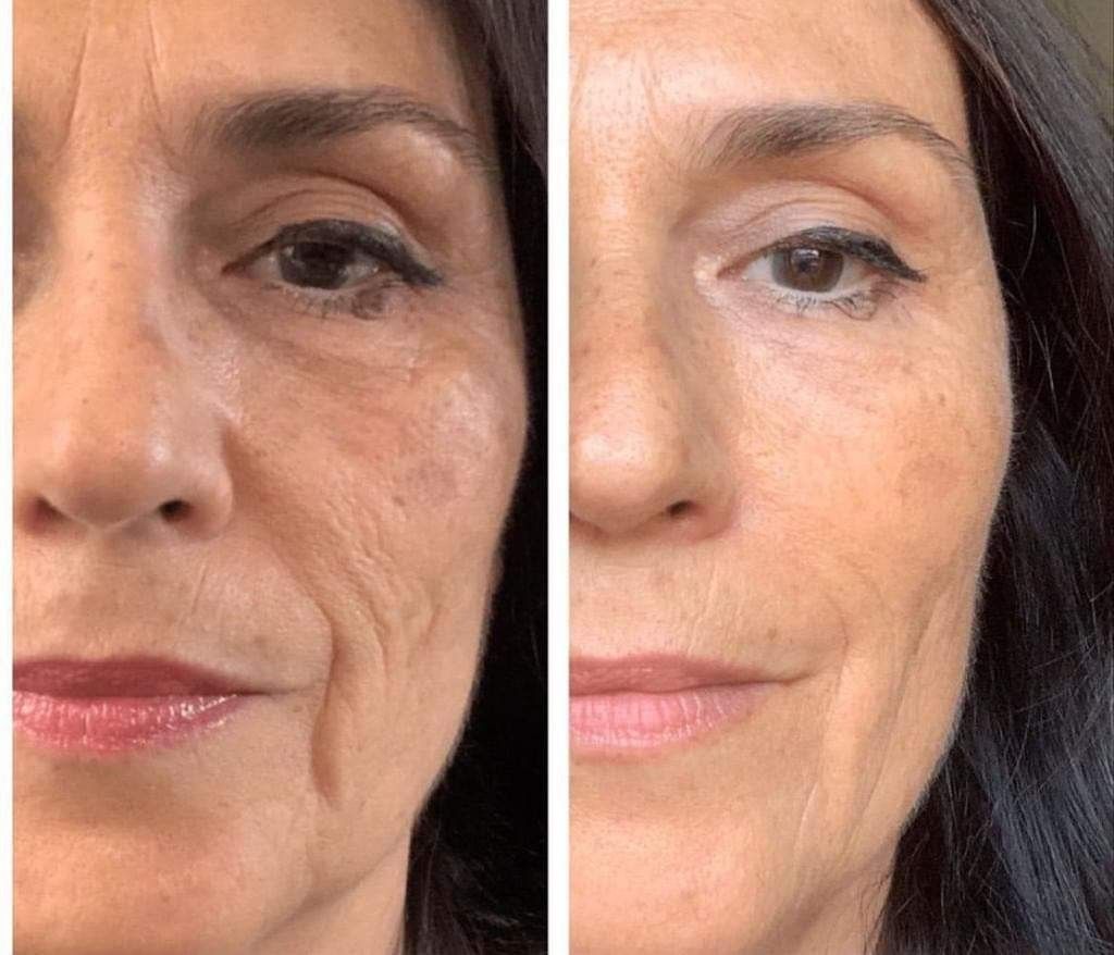 Sérum Visage 5-en-1 repulpant et régénérant
