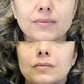 Sérum Visage 5-en-1 repulpant et régénérant