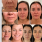 Sérum Visage 5-en-1 repulpant et régénérant