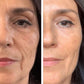 Sérum Visage 5-en-1 repulpant et régénérant
